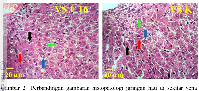 Gambar 2  Perbandingan gambaran histopatologi jaringan hati di sekitar vena 
