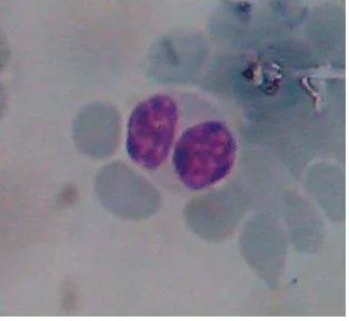 Gambar 10  Eosinofil 