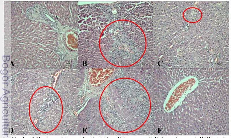 Gambar 3 Gambaran histopatologi hati tikus. Keterangan: A) Kelompok normal, B) Kontrol 