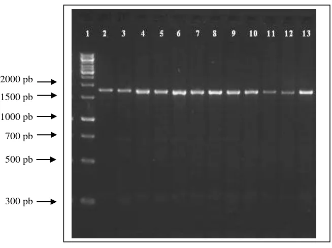 Gambar 3. Produk yang diperoleh dari hasil amplifikasi primer yang didesain khusus pada ekson 7 (forward) dan ekson 9 (reverse) dengan ukuran sekitar 1800 pb 
