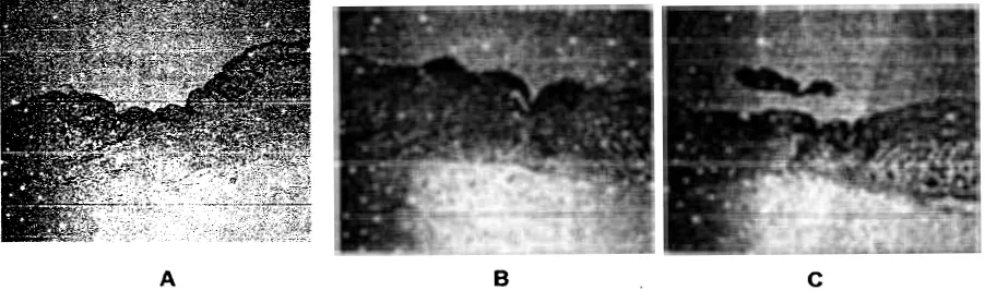 Gambar 1. Perbendingan luka secara mikroskopis pada hari ke-7 pasca perlakuan. A. Kelompok !<ontrol negatif, teTdapat infiltrasi sel radang dan mulai terbentuk re-epitPl (55,33%); B