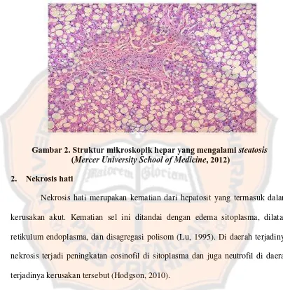 Gambar 2. Struktur mikroskopik hepar yang mengalami steatosis  (Mercer University School of Medicine, 2012) 