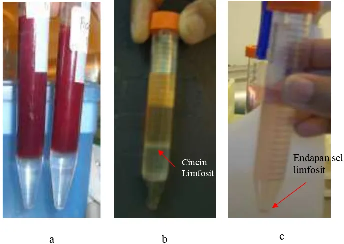 Gambar� 5� Isolasi� limfosit� berdasarkan� perbedaan� densitas� larutan� ficoll�histopaque� (a)� Bufficoat� yang� dilewatkan� ficoll,� (b)� Pemisahan�dengan�ficoll�yang�menghasilkan�cincin�limfosit�dan�(c)�Endapan�sel�limfosit�hasil�pemisahan��