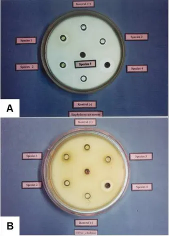 Gambar 3. Bioaktivitas ekstrak spons dari Pulau Lae-Lae terhadap bakteri Staphylococus aureus (A) dan terhadap bakteri Vibrio cholerae (B).