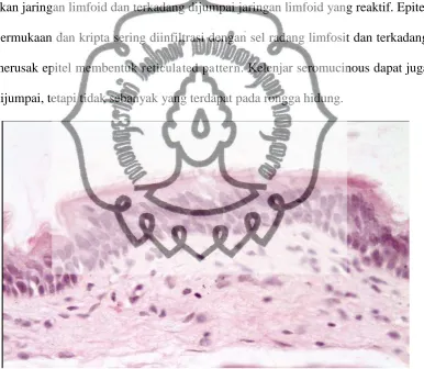 Gambar 2.2. Sel epitel transisional, pelapis nasofaring (Dikutip dari : Respiratory system pre lab (cited 2010 Jan 5)