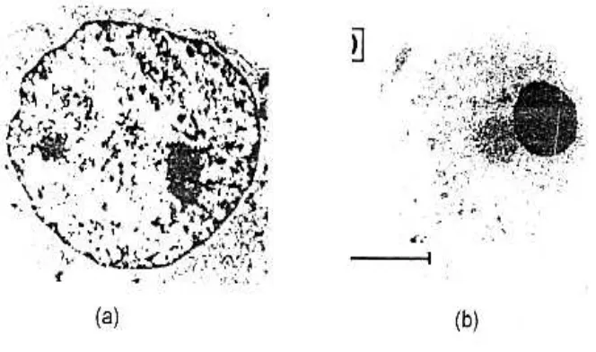 Gambar 5     Foto mikroskop elektron dari : a) sel normal dan  b) sel 