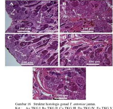 Gambar 16   Struktur histologis gonad T. antoniae jantan.  