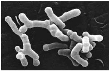 Gambar 1 Bifidobacterium longum (Anonim 2006) 