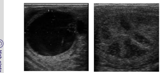 Gambar 3 Salah satu pencitraan ultrasonografi perektal B-mode. Kiri: folikel praovulatori