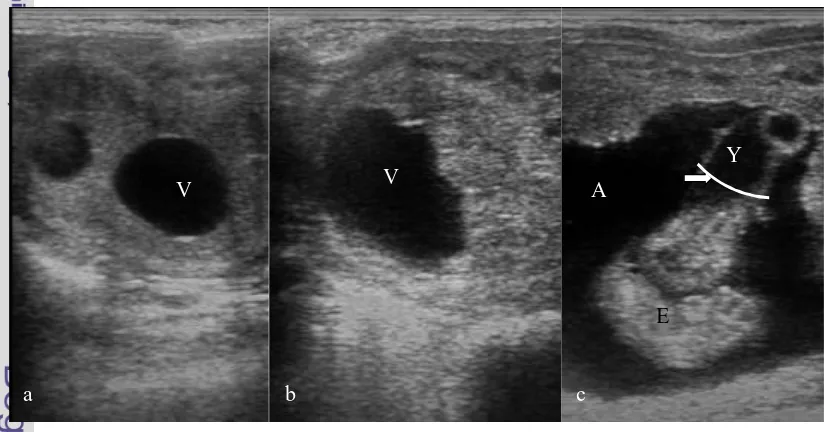 Gambar 5 Gambaran ultrasonografi kebuntingan kuda: (a) adanya massa anechoic pada 