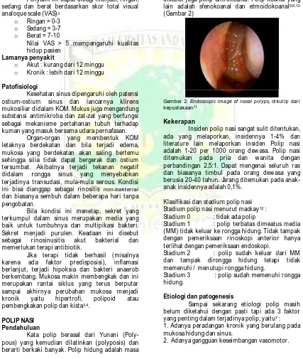 Gambar 2.  Endoscopic image of nasal polyps, dikutip dari      kepustakaan