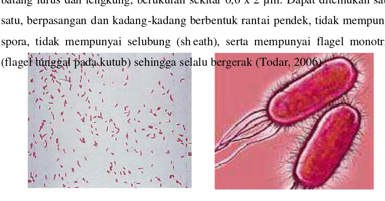 Gambar. 1Pseudomonas aeruginosa