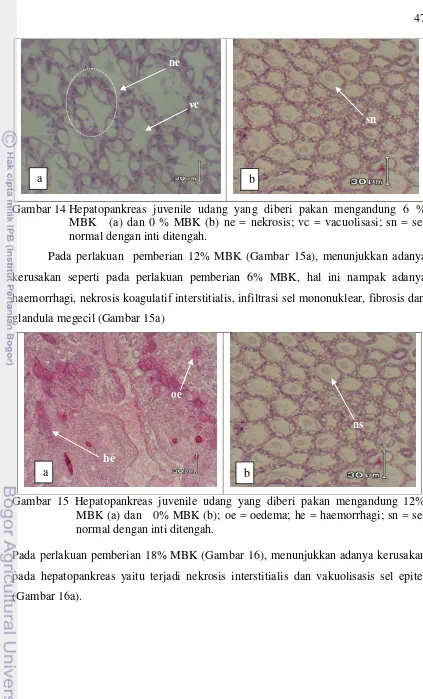 Gambar 14 Hepatopankreas juvenile udang yang diberi pakan mengandung 6 % 