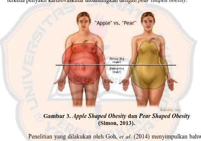 Gambar 3.  Apple Shaped Obesity dan Pear Shaped Obesity (Simon, 2013). 