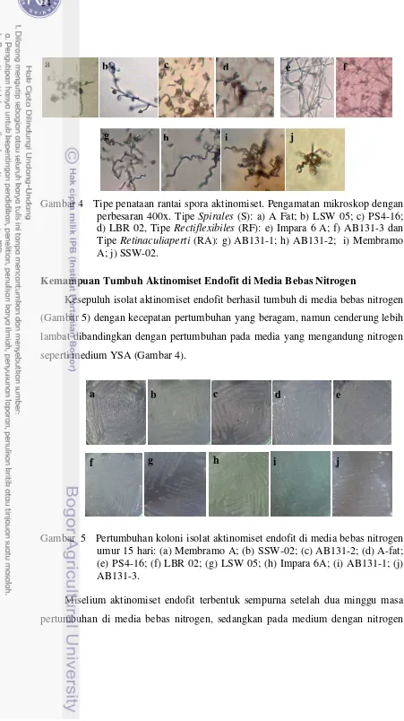 Gambar 4   Tipe penataan rantai spora aktinomiset. Pengamatan mikroskop dengan 