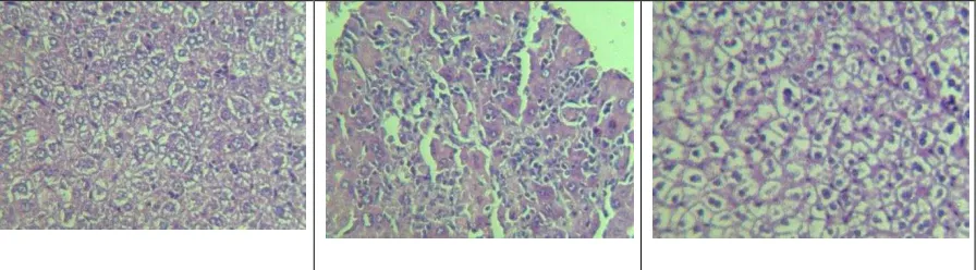 Fig. 2: The effect  of Pc-1 and Pc-2 on liver, 21th day after Lysteria monocytogenes infection on BALB/c mice