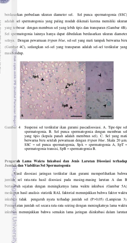 Gambar  4   Suspensi sel testikular ikan gurami pascadisosiasi. A. Tipe-tipe sel 