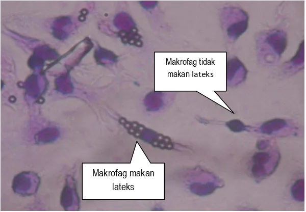 Gambar 4. Fagositosis lateks oleh makrofag peritoneal mencit setelah diinfeksi dengan L