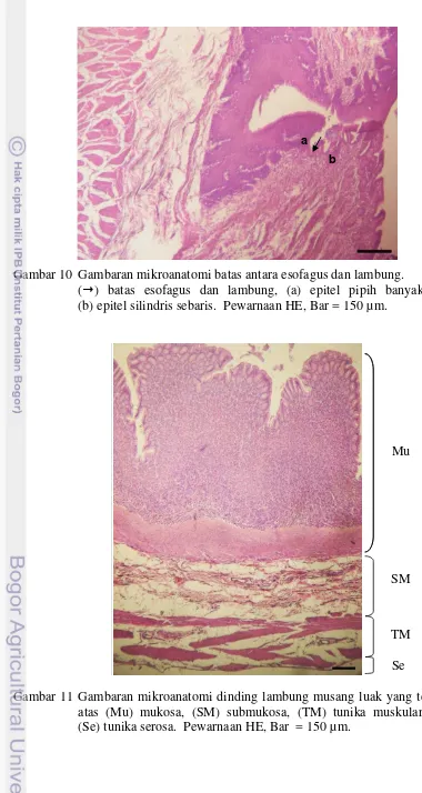 Gambar 10 Gambaran mikroanatomi batas antara esofagus dan lambung. 