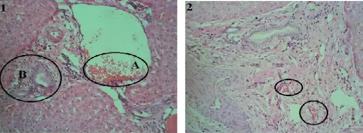 Gambar 10 Histopatologi hati sapi yang mengalami kerusakan derajat ringan (+1).1. A. Kongesti vena porta berisi eritrosit; B