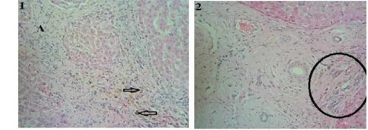 Gambar 11 Histopatologi hati sapi yang mengalami kerusakan derajat sedang (+2).1.Terdapat proliferasi buluh empedu dan infiltrasi sel radang