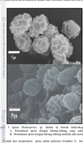 Gambar 5 Spora Heimioporus sp. dilihat di bawah mikroskop SEM.                    