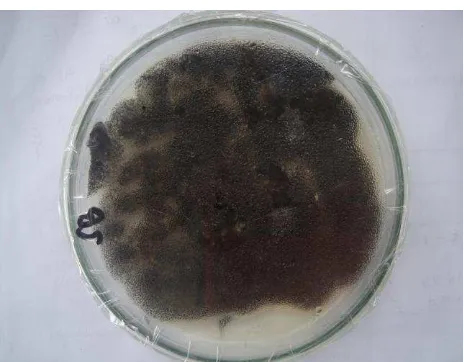 Figure 4. Aspergillus niger’s colony on Sabouroud agar  