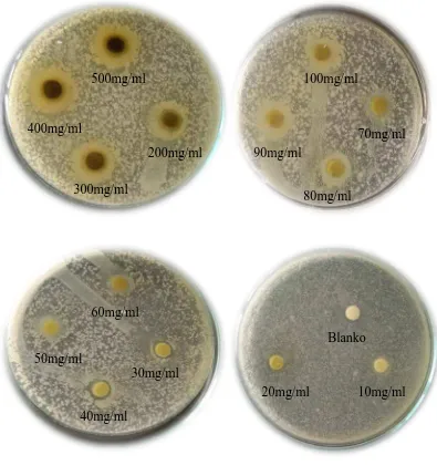 Gambar hasil uji aktivitas antibakteri ekstrak terhadap bakteri Staphylococcus aureus 