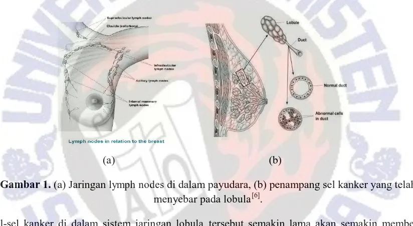 Gambar 1. (a) Jaringan lymph nodes di dalam payudara, (b) penampang sel kanker yang telah menyebar pada lobula[6]