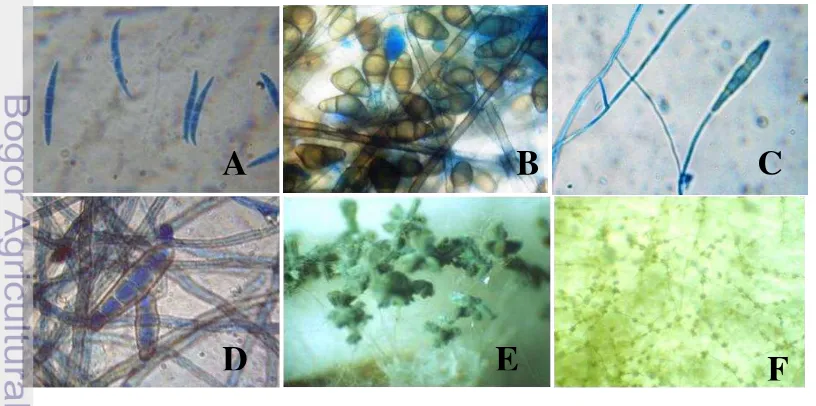 Gambar  2  Spora cendawan yang terdeteksi pada benih padi dengan mikroskop compound (A) Fusarium sp., (B) Curvularia sp., (C) Alternariasp., (D) Drechslera sp.; dan terdeteksi dengan mikroskop stereo (E) Penicillium sp, (F) Cladosporium sp