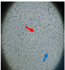 Gambar 2. Morfologi sel T47D                                                                                                                     = sel mati 