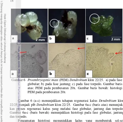 Gambar 6 (a-c) menunjukkan tahapan regenerasi kalus Dendrobium 22/25 menjadi plb kan proses regenerasi kalus yang melalui fase globular, jantung dan torpedo