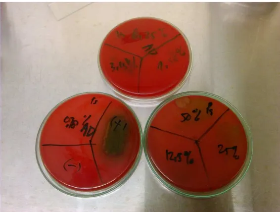 Gambar 11 Pertumbuhan Koloni Bakteri Pseudomonas aeruninosa pada agar 