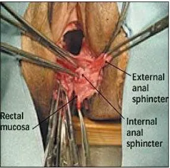 Gambar 1. Muskulus pada perineum. 