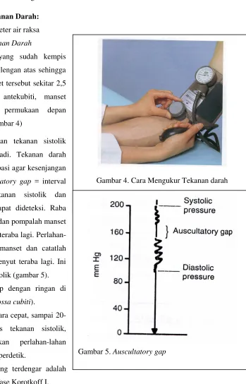 Gambar 5. Auscultatory gap                  