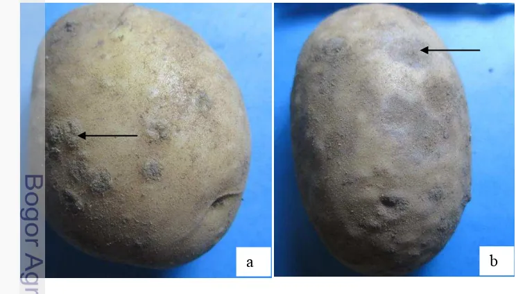 Gambar 2  Gejala penyakit kudis pada umbi kentang; (a) tipe menonjol, (b) tipe 