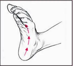 Gambar 6. Foot grasping reflex 