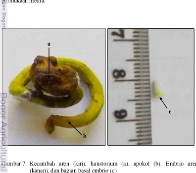 Gambar 7.  Kecambah aren (kiri), haustorium (a), apokol (b). Embrio aren 