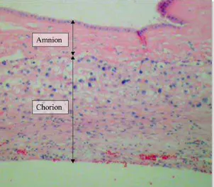 Gambar 3. Preparat histologi pewarnaan hematoxylin dan eosin (H&E) membran korioamnion dari kehamilan 39 minggu yang dilahirkan dengan repeat seksio sesaria sebelum dimulainya proses persalinan