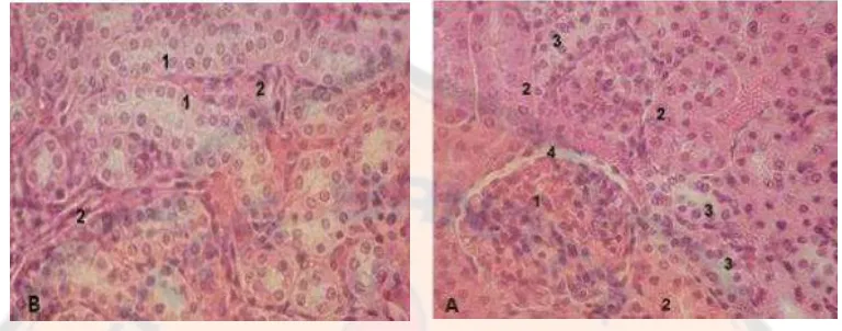 Gambar 9. Gambaran mikroskopik ginjal normal (diwarnai dengan  dan haematoxylin . (A) Korteks ginjal, 1: ; 2: ; 3: 