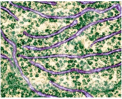 Gambar 1.10. Foto menggunakan Mikroskop Elektron dari Retikulum  endoplasma dan ribosom
