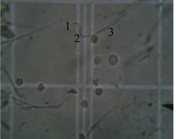 Gambar 4.2.1 Spermatozoa Normal  