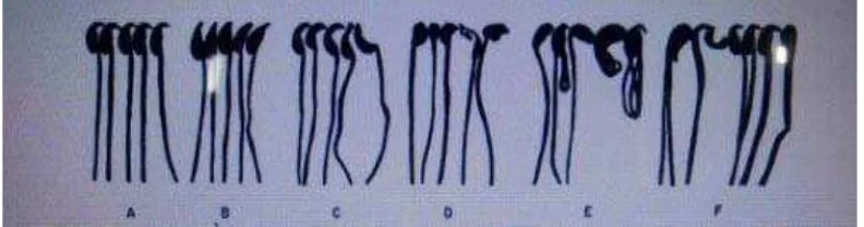 Gambar 2.5.1 Morfologi Spermatozoa mencit. (a) Spermatozoa Normal, (b) Pengait tumpul, (c) Pengait pendek, (d) Kepala terjepit, (e) Sperma berekor ganda dengan kepala tidak berbentuk (f) Kepala sperma tidak berbentuk
