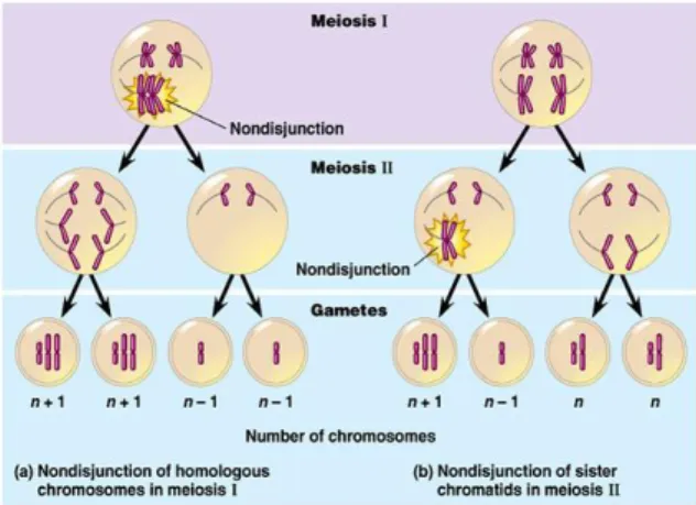 Gambar 3. Peristiwa Nondisjunction pada Meiosis I dan II  Ciri – ciri penderita Sindrom Down 