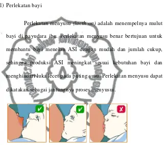 Gambar 2.5. Perlekatan menyusu  