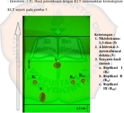 Gambar 5. Penampakan lempeng KLT dibawah sinar UV 254 nm