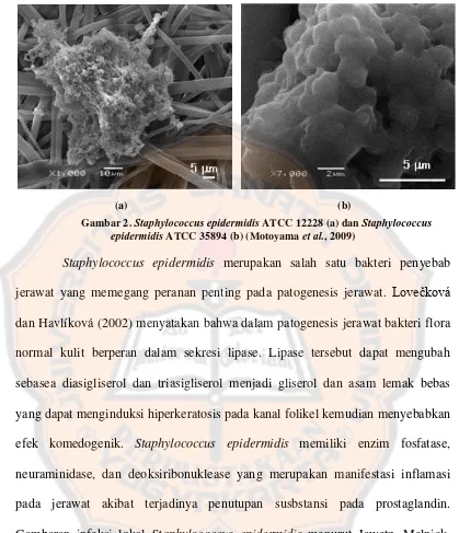 Gambar 2. Staphylococcus epidermidis ATCC 12228 (a) dan Staphylococcus epidermidis et al.