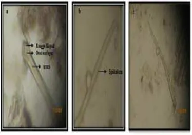 Gambar 4.5.Cacing Parasitik Camallanus sp. yang  menginfeksi saluran  pencernaan ikan patin dalam  larutan   NaCl  fisiologis 0,85%  dengan     perbesaran    40 x 10 lensa objektif  a
