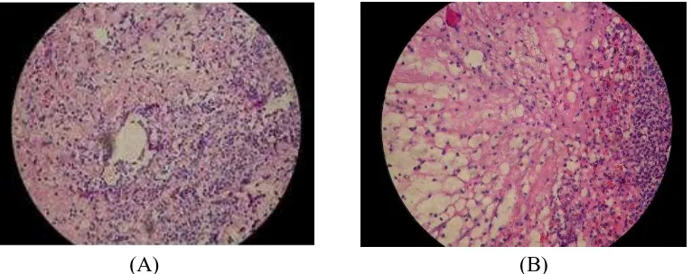 Gambar 2.  Fotomikroskopik gambaran leukosit PMN (sel yang berbentuk bulat dengan inti berbentuk tapal kuda yang terletak dipinggir, 