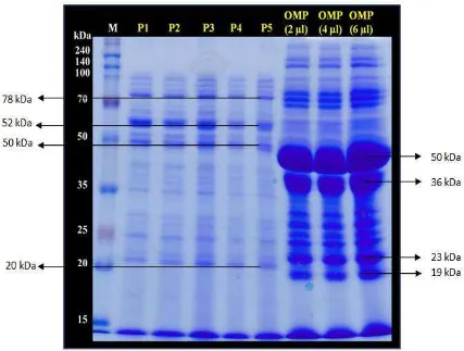 Gambar 3. Hasil SDS-PAGE potongan pili dan protein permukaan S. pneumoniaeKeterangan : M merupakan marker, P1-5, berturut-turut potongan pili ke 1 sd ke 5             OMP merupakan protein permukaan 